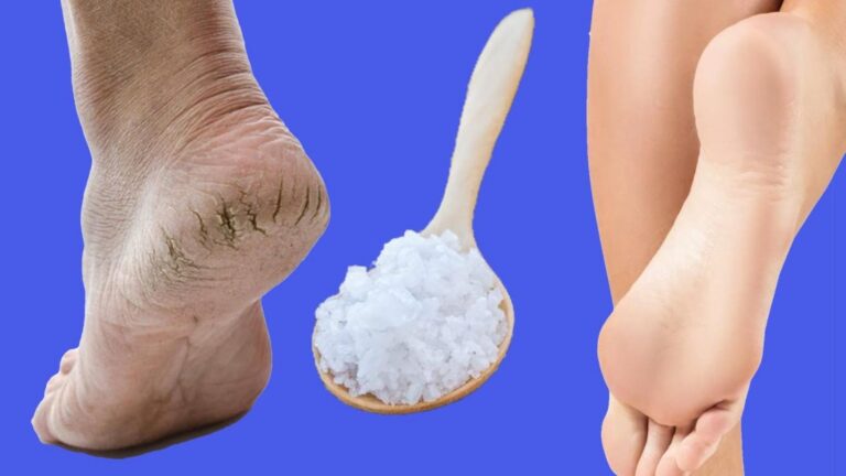 Cette astuce simple transforme vos talons abîmés en pieds de bébé… Vous ne le regretterez