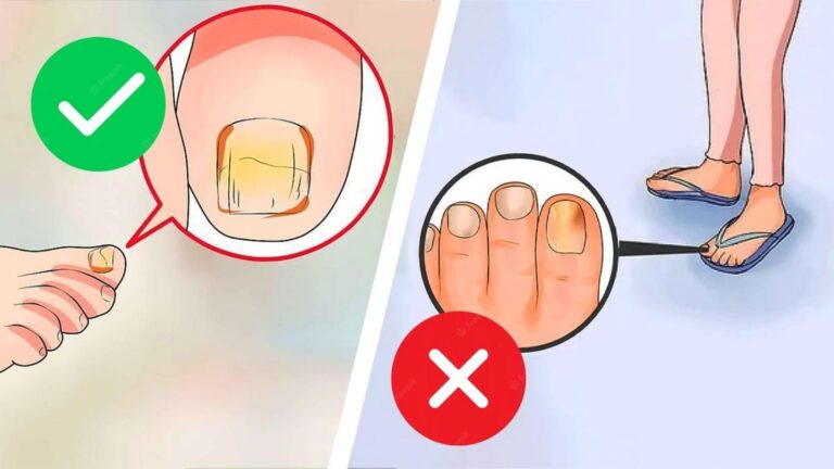 Cette méthode simple transforme vos ongles malades en une belle santé…
