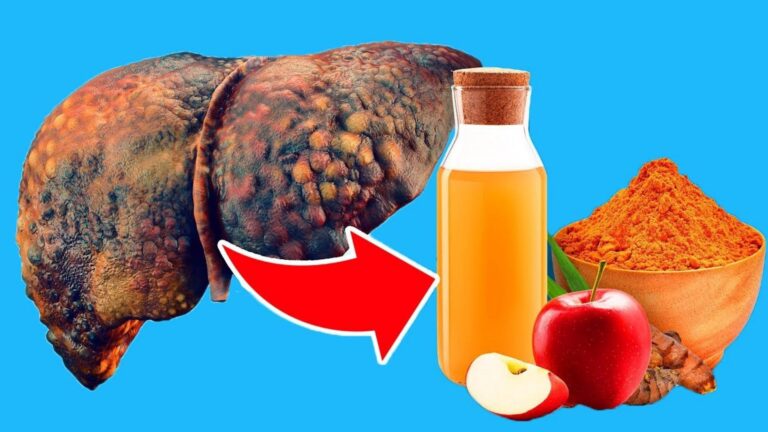 Une vieille astuce pour transformer ta santé avec du vinaigre de cidre et du curcuma…